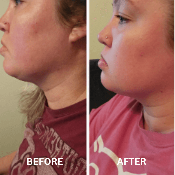 Soltherapy™ Face Massager